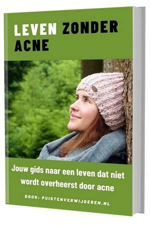 leven zonder acne ebook